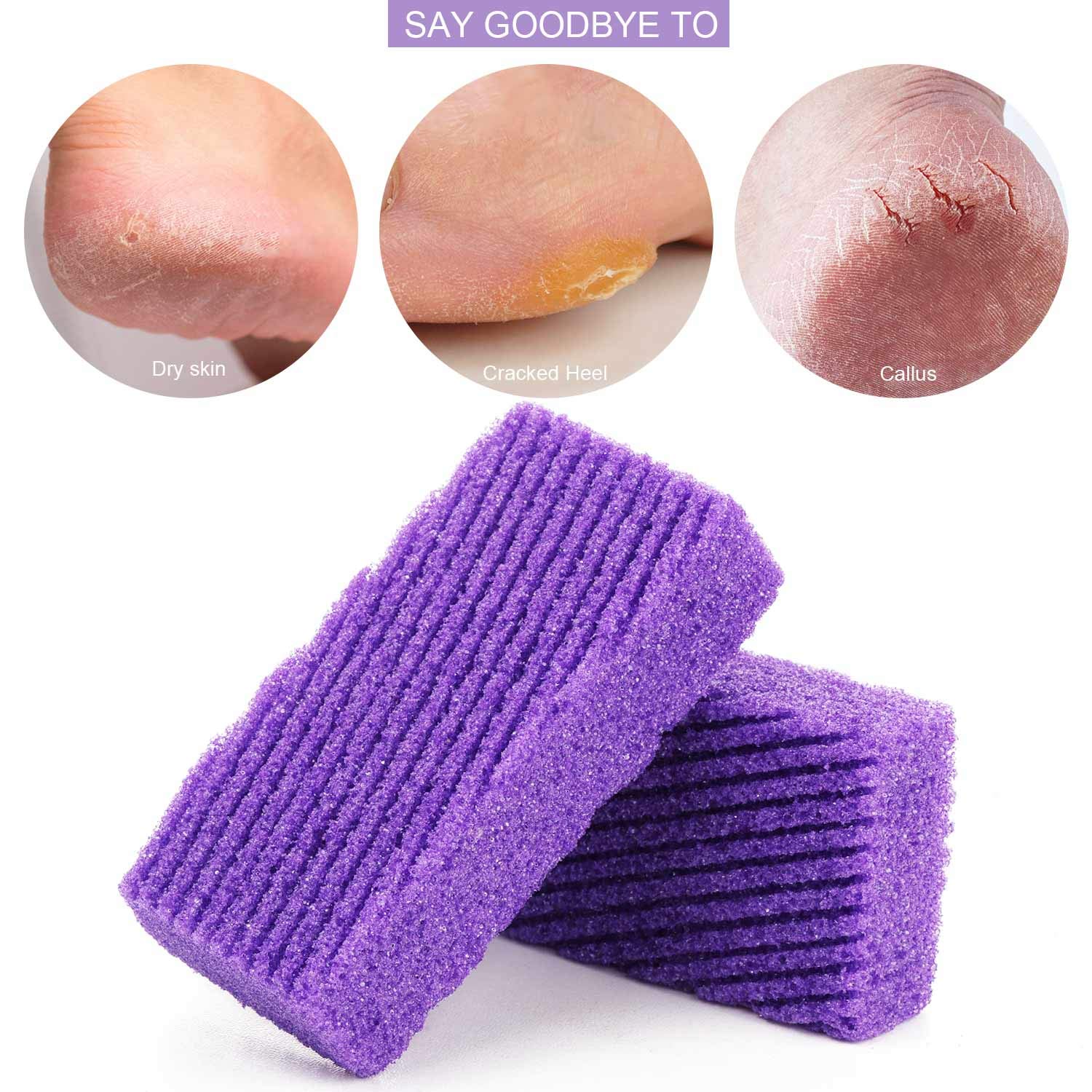 Foot Pumice Stone, 6 pcs Pumi Bar Pad, Exfoliating Sponge to Scrub Hard Dead Skin, Callus removal: Beauty