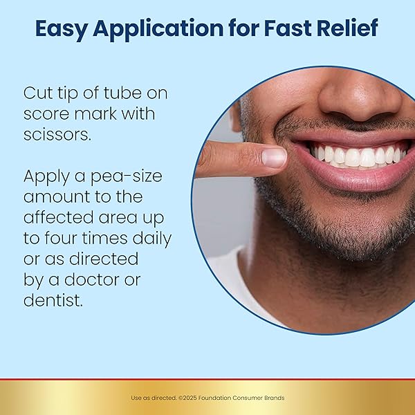 ANBESOL MAXIMUM STRENGTH GEL – INSTANT ORAL PAIN RELIEF, FOR TOOTHACHES, GUMS, BRACES, & DENTURE PAIN, AND MOUTH SORES*, CANKER SORE TREATMENT INSIDE MOUTH, ADA ACCEPTED, 0.33 OZ