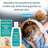 Avatopia Cradle Cap Treatment Shampoo 125ml with Nit Comb Baby Kids view 2