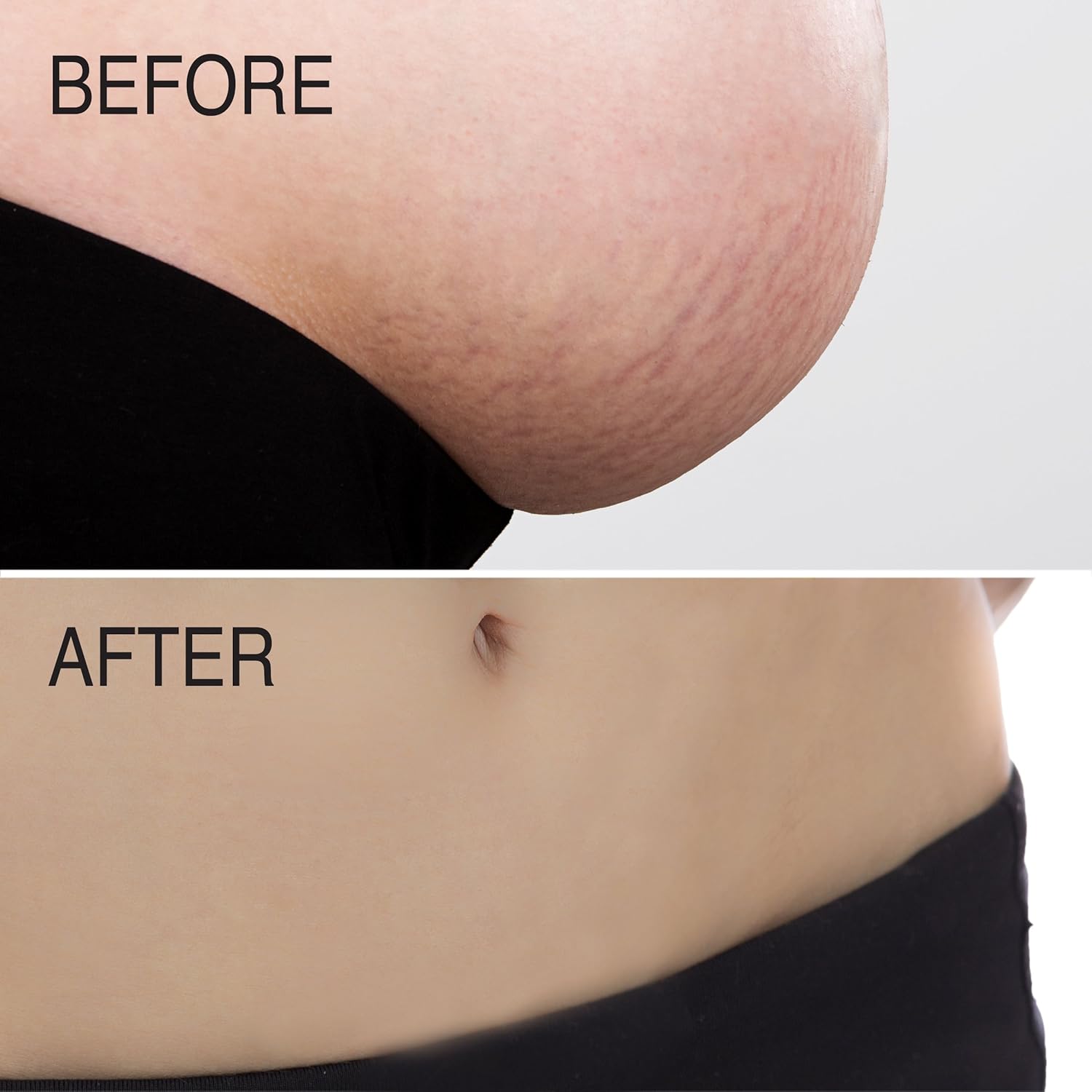 advanced clinicals stretch mark intensive care lotion