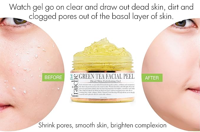 Amazon Com Live Fraiche 24k Gold Brightening Facial Peeling Gel Green Tea 4 23oz Secret Cure To Clogged Pores Gentle Deep Exfoliator Key To Remove Dead Skin Dirt For Forever Flawless Clearer