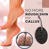 Eco Bath London Natural Pumice Stone Black Foot Scrubber for Callus Removal view 5