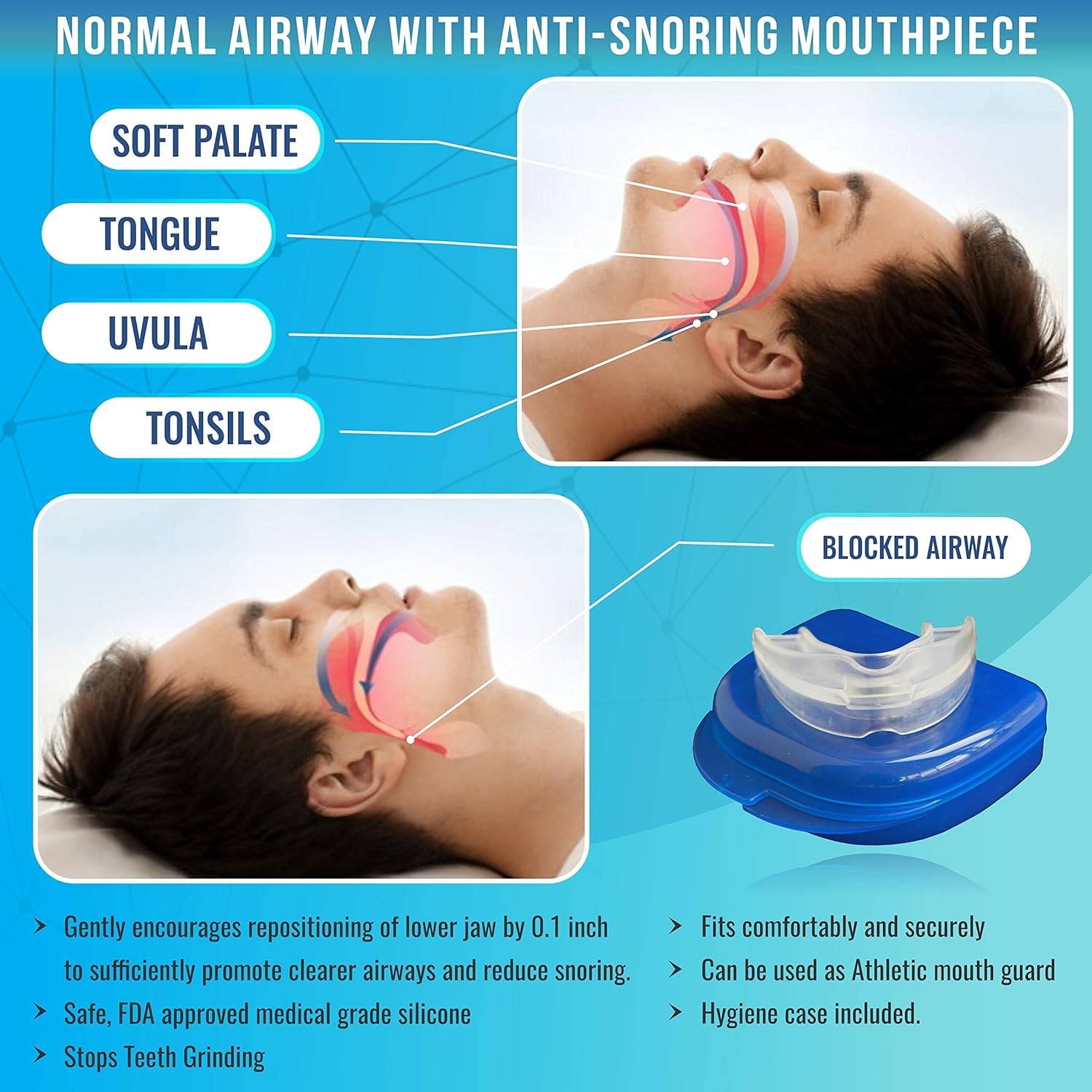 Anti Snore Devices Kit - Image 4