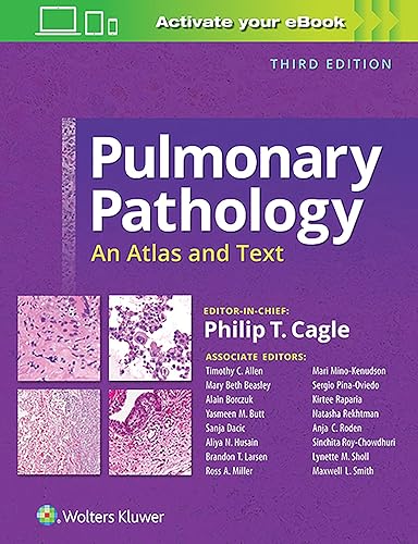 Download Pulmonary Pathology: An Atlas and Text PDF