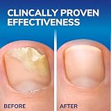 Scholl Fungal Nail Treatment 3.8ml by Dr. Scholl's - 2 in 1 System view 9