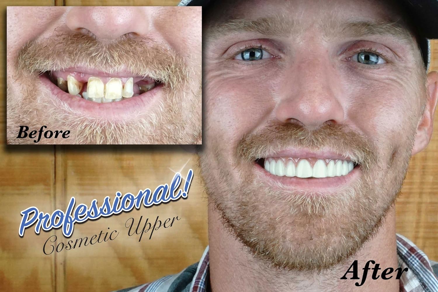 Professional Cosmetic Upper - New from Instant Smile! Hand crafted detail, custom fit at home! Works Best in Medium to Large Sized Mouths. : Beauty