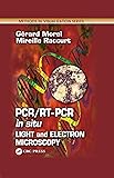 PCR/RT- PCR in situ: Light and Electron Microscopy