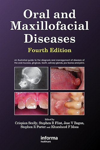 Download Oral and Maxillofacial Diseases (English Edition) PDF