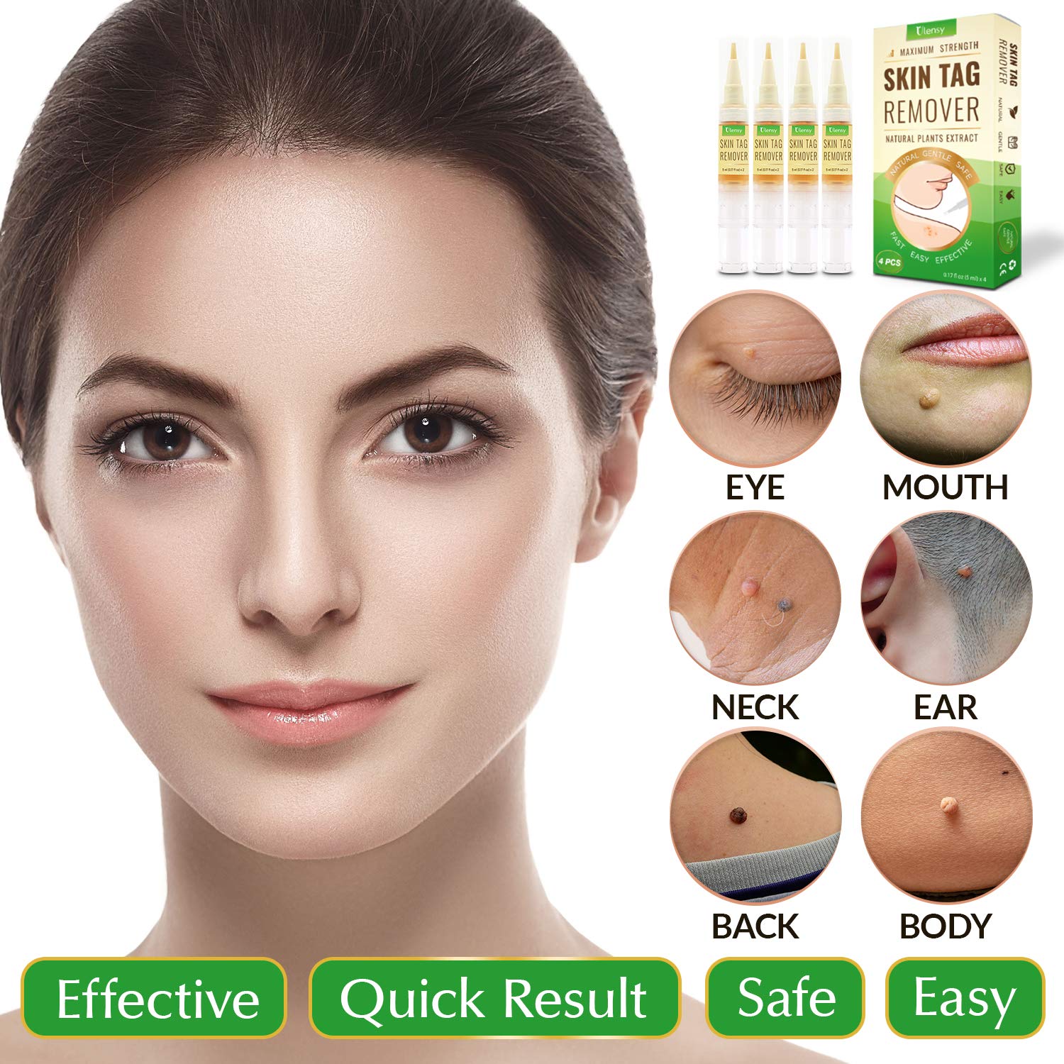 Ulensy 4 PCS Skin Tag Remover with Advanced Formula, Remove Skin Tag Efficiently, Easy and Fast-Acting Skin Tag Remover, 20 ML : Beauty
