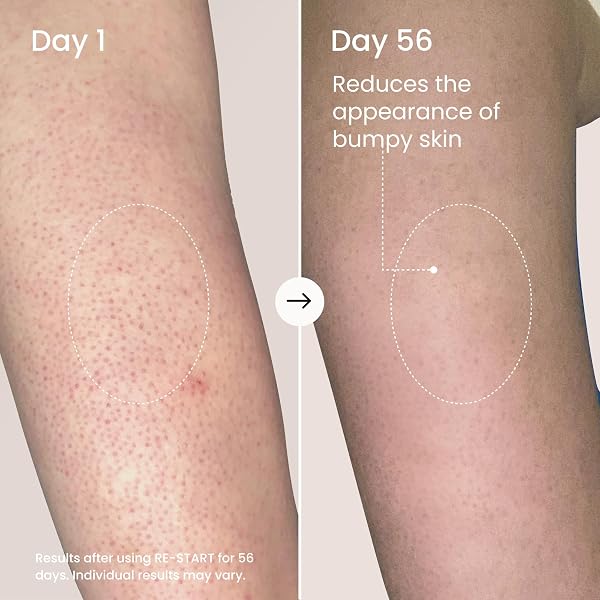 MAËLYS RE-START RESURFACING BODY SERUM – AHA EXFOLIATING TREATMENT WITH HYALURONIC FUSION, GLYCOLIC ACID, AND NIACINAMIDE FOR BUMPY SKIN AND UNEVEN TEXTURE (3.5 FL OZ)