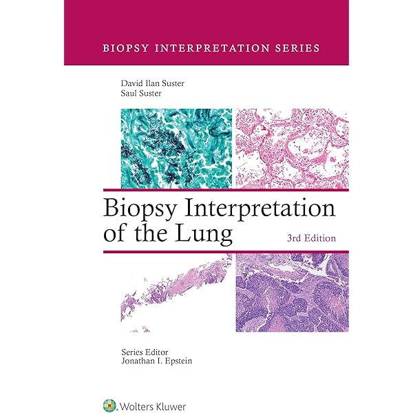 Amazon.com: Diagnostic Histopathology of Tumors E-Book: Expert