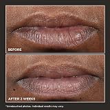 Perricone MD Cold Plasma Plus+ Lip Therapy 4.2g Multi-Action Lip Treatment view 4