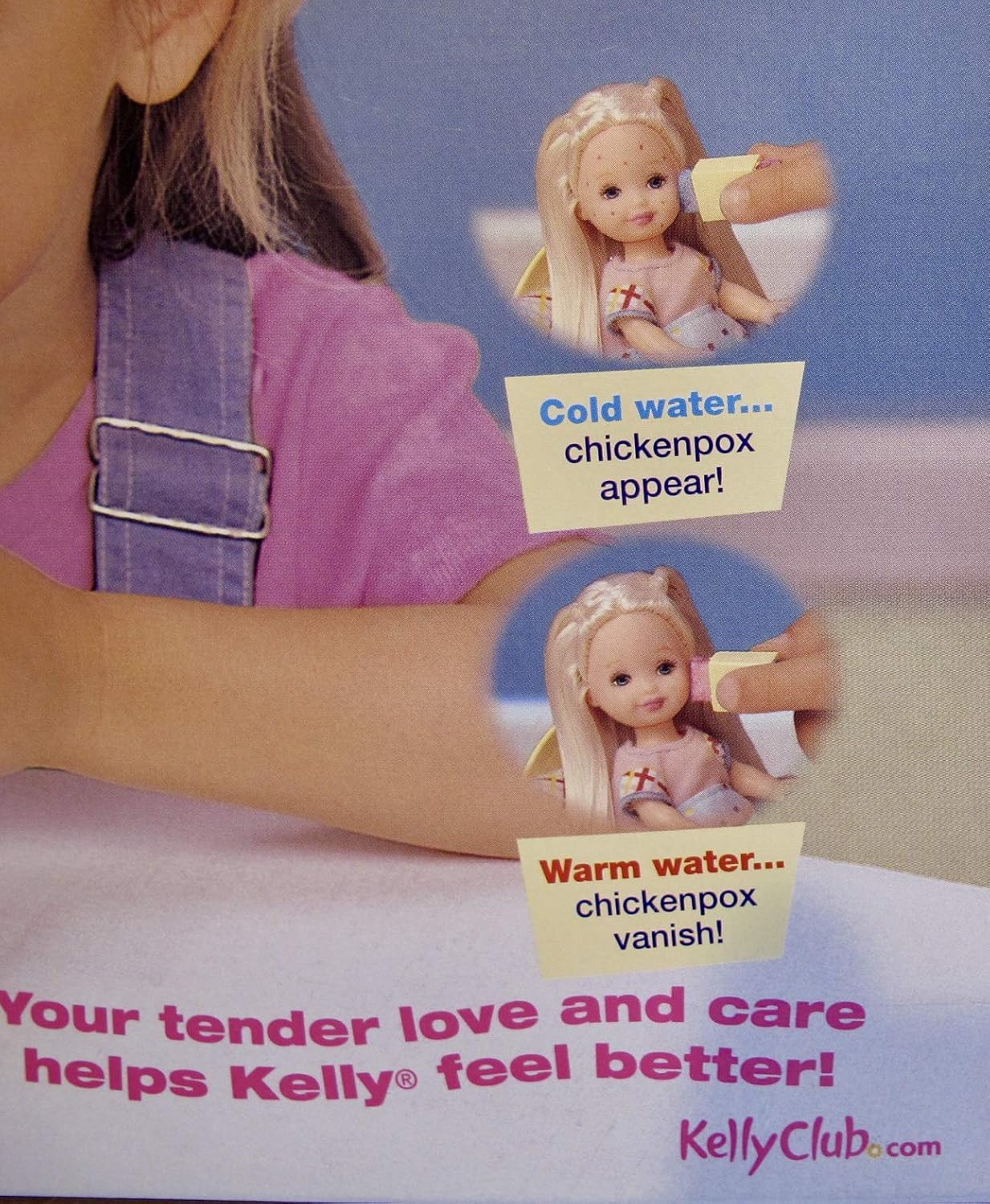 muñeca kelly varicela