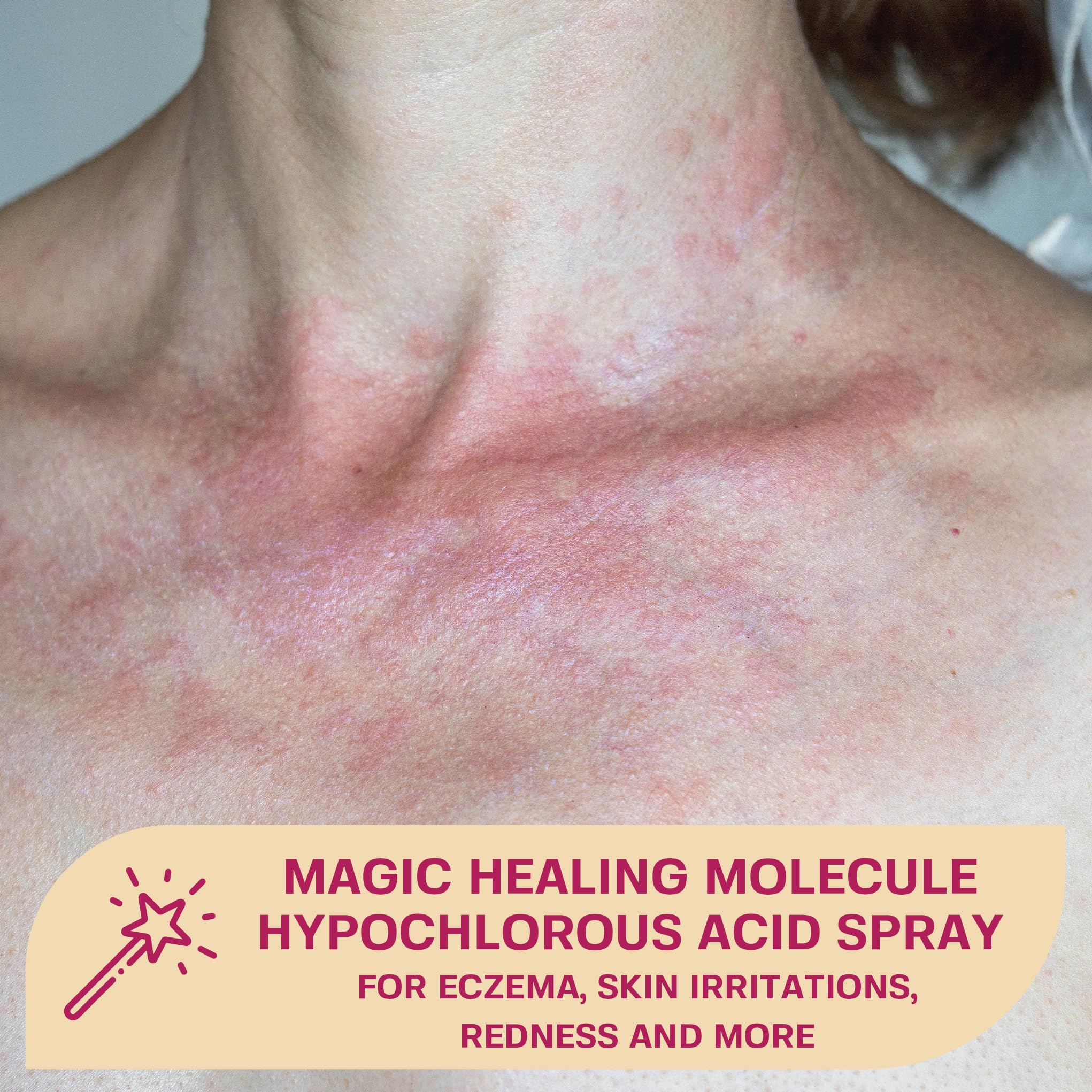 BASE LABORATORIES Hypochlorous Acid Spray for Face & Skin | 8oz | Facial Spray Daily Skin Repair Solution for Sensitive Skin, Redness, Irritations, Eczema | Hypochlrous HOCL Molecule | 2PK