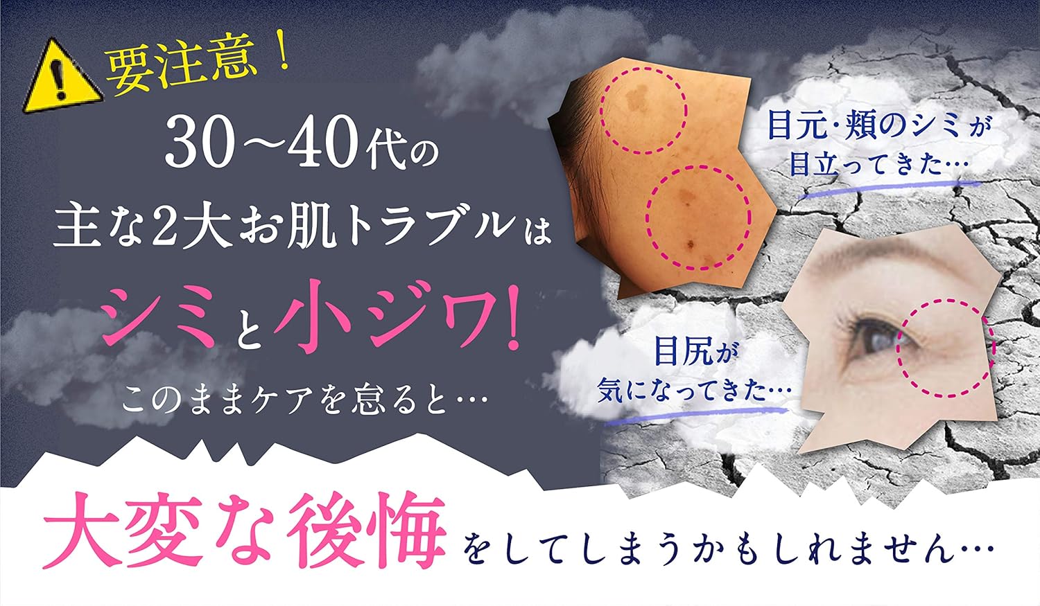 Amazon 医薬部外品 ビハクシア 公式 Vihaxia 1本27g シミ シワ ニキビ 対策 美白 クリーム 薬用 美肌 ハイドロキノン誘導体 ビタミンc誘導体 グルチルリチン酸 配合 ビハクシア 乳液 クリーム 通販 Amazon 医薬部外品 ビハクシア 公式 Vihaxia 1本27g シミ シワ ニキビ 対策 美白 クリーム 薬用 美肌 ハイドロキノン誘導体 ビタミンc誘導体 グルチルリチン酸 配合 ビハクシア 乳液 クリーム 通販