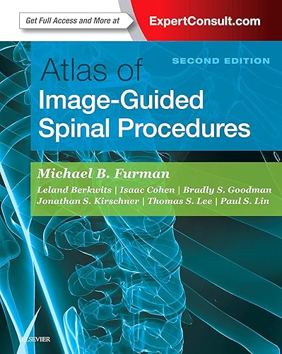 Download Atlas of Image-Guided Spinal Procedures PDF