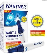 WARTNER Cryo Freeze Wart & Verruca Remover Carbon Freeze Technology view 2
