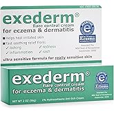 Exederm Flare Control Cream for Eczema & Dermatitis, 2oz