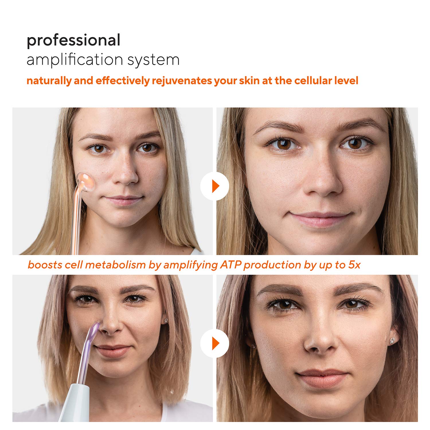 NuDerma Professional Skin Therapy Wand - Portable Handheld High Frequency Skin Therapy Machine with 6 Neon & Argon Wands - Acne Treatment - Skin Tightening - Wrinkle Reducing – Facial Skin Lifter: Beauty