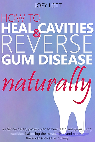 Download How to Heal Cavities and Reverse Gum Disease Naturally: a science-based, proven plan to heal teeth and gums using nutrition, balancing the metabolism, ... such as oil pulling (English Edition) PDF