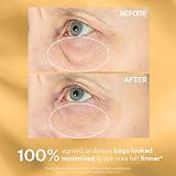 StriVectin Tighten & Lift Hyperlift Eye Cream 0.34 Oz 10ml Instant Eye Fix view 6