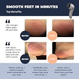 Own Harmony Electric Hard Skin Remover with Vacuum Absorption - Foot Callus File view 3
