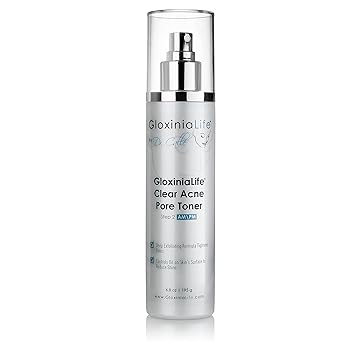 does toner clear acne