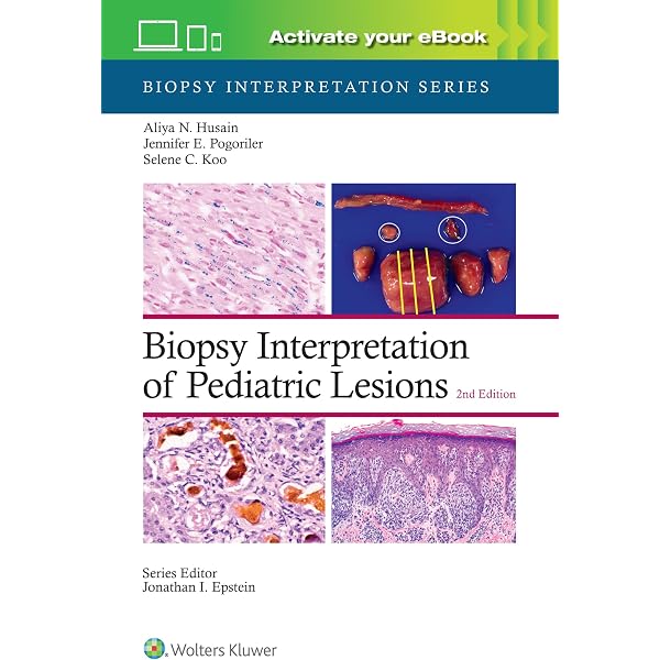 Diagnostic Pathology: Pediatric Neoplasms: 9780443224263: Medicine
