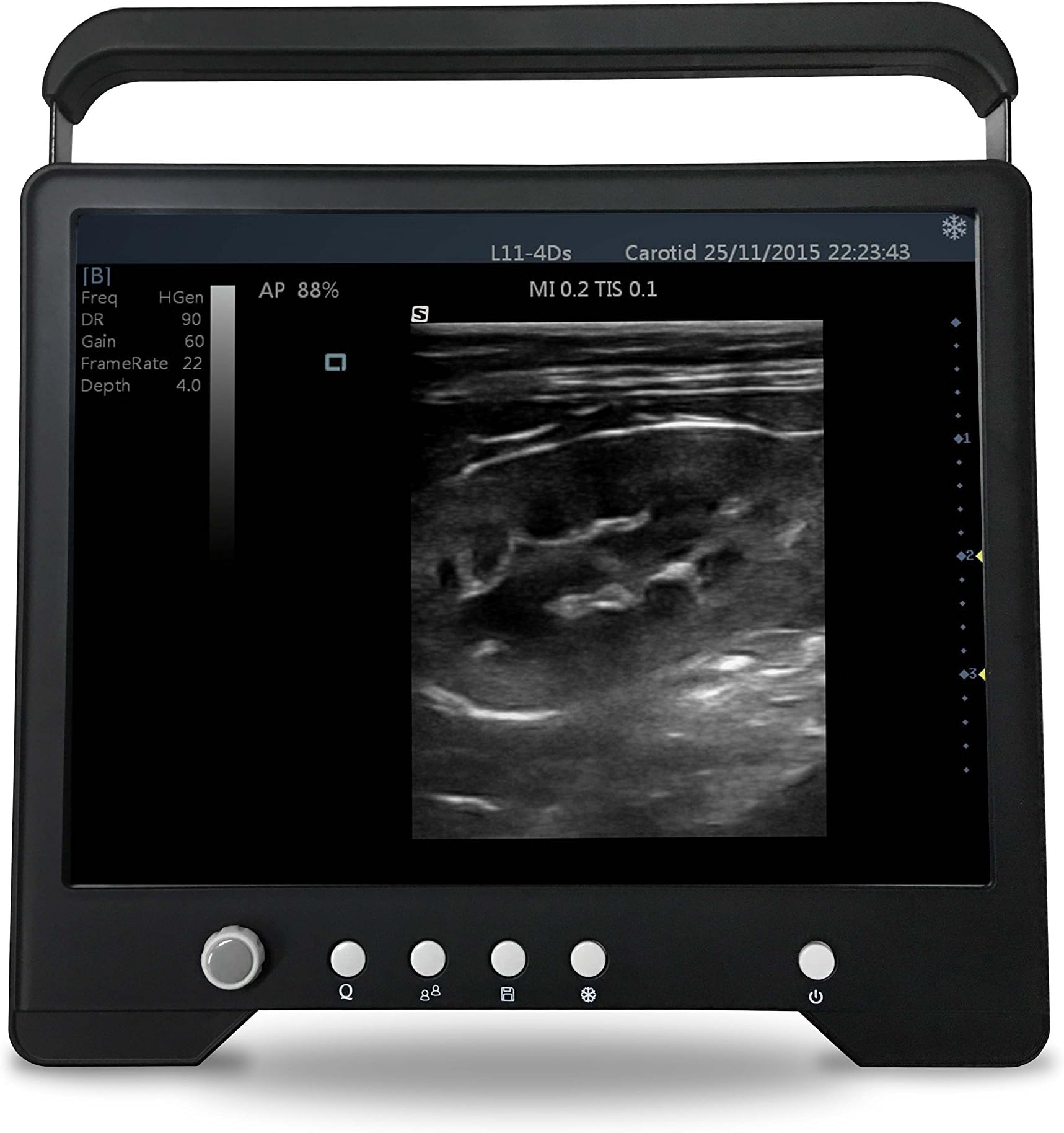 Veterinary Tablet Touchscreen Ultrasound with one Rectal Probe