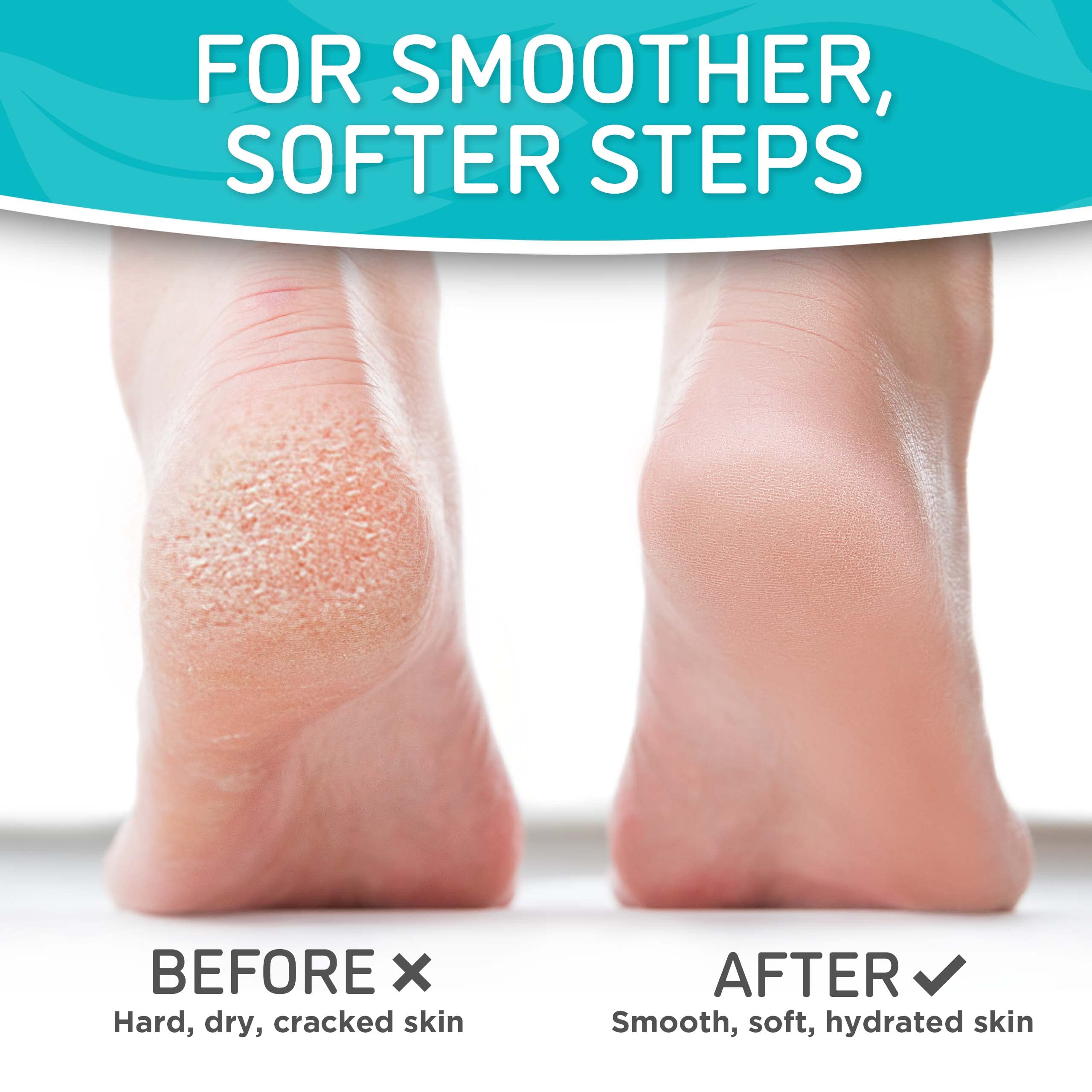 Dermora Soft Touch Exfoliating Foot Peel Mask – Pack of 2 - For Dry, Cracked Heels, Calluses & Baby Soft Skin - Peppermint - Exfoliating Foot Peeling Mask