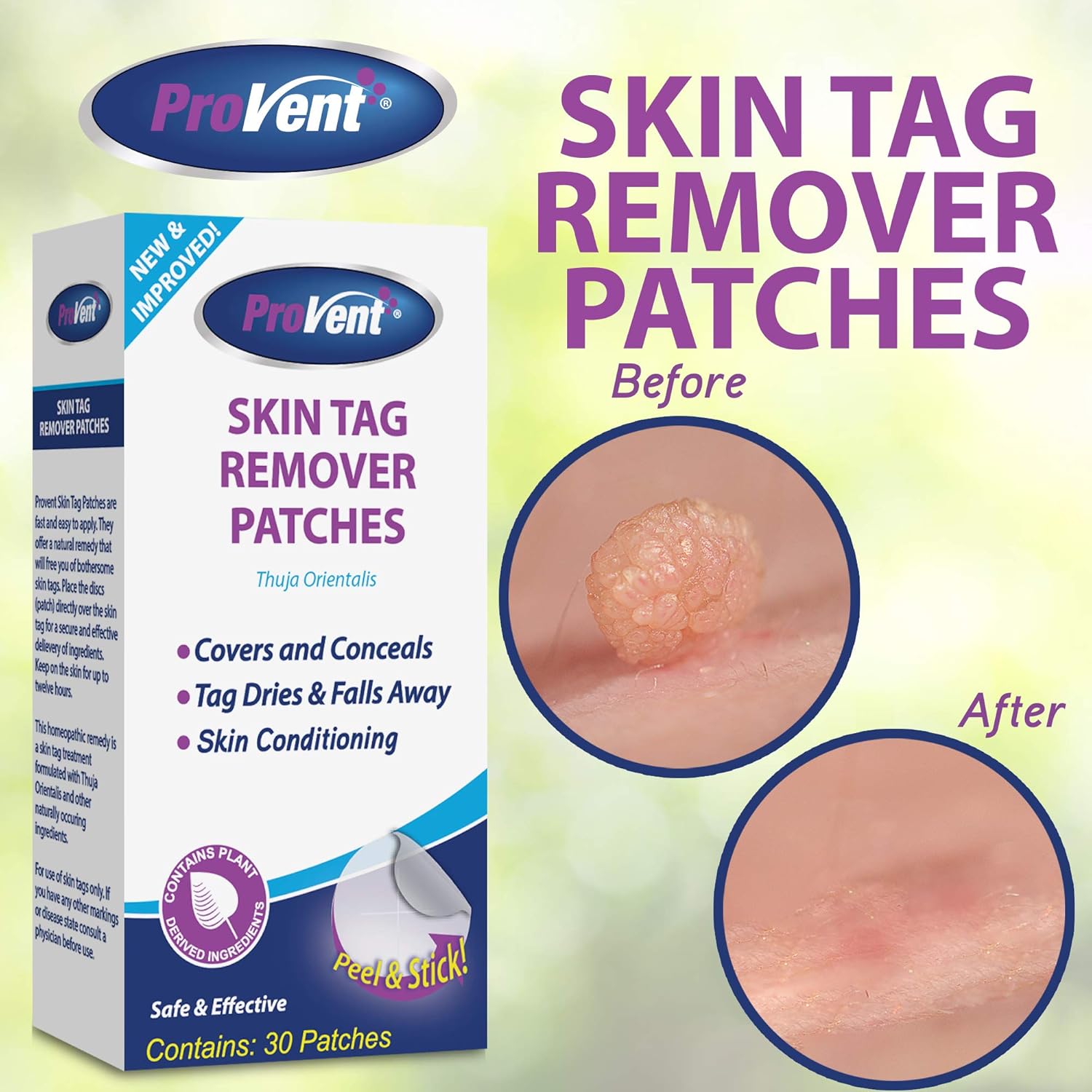 Provent Skin Tag Remover Patches, 30 Count, NEW AND IMPROVED FORMULATION, Homeopathic Medicated Patch, Dries Tags and falls away. Covers and conceals skin tags 100% Natural Ingredients. : Beauty