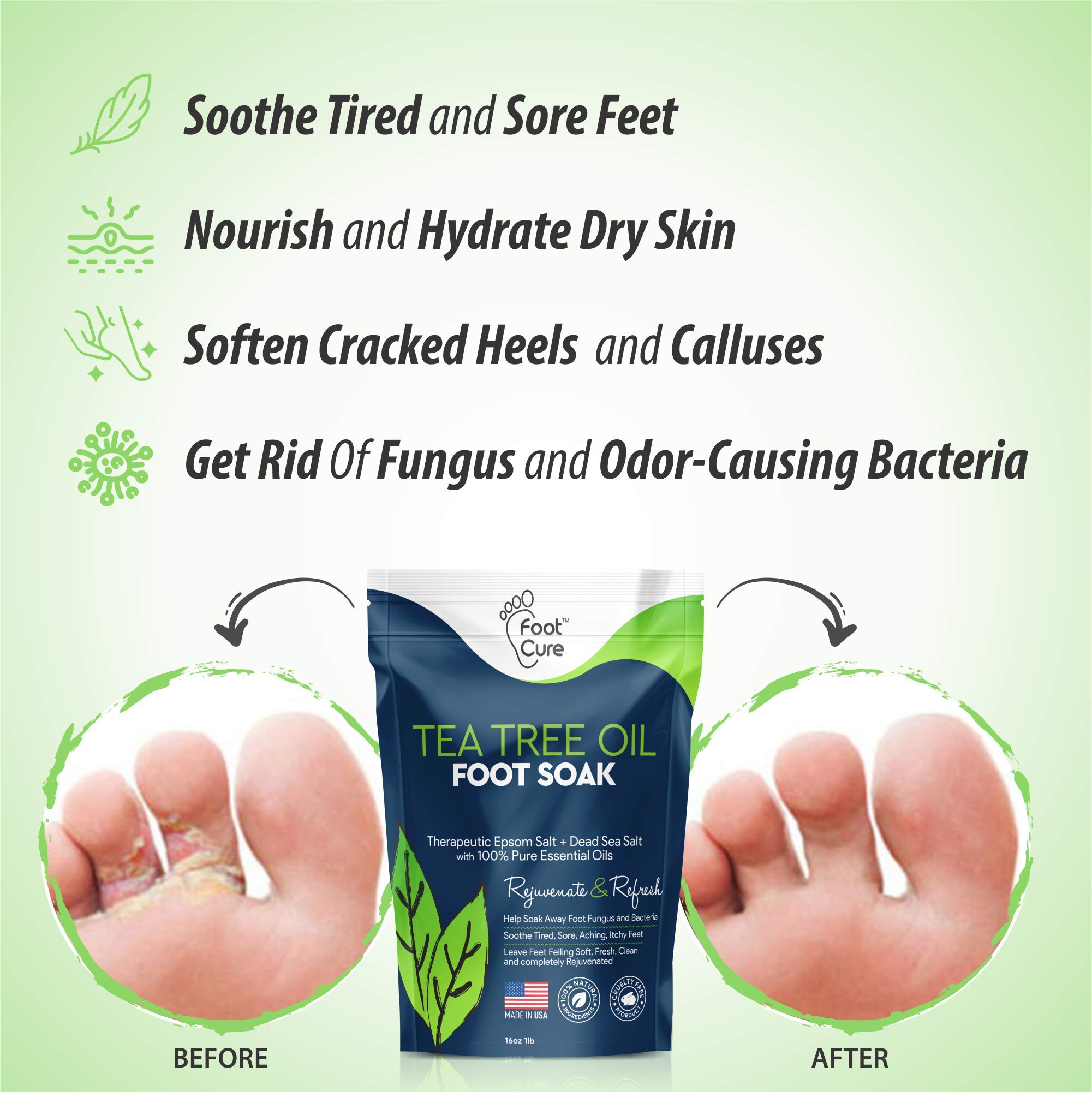 Mua Foot Cure Tea Tree Oil Foot SOAK with EPSOM Salt Extra Strength