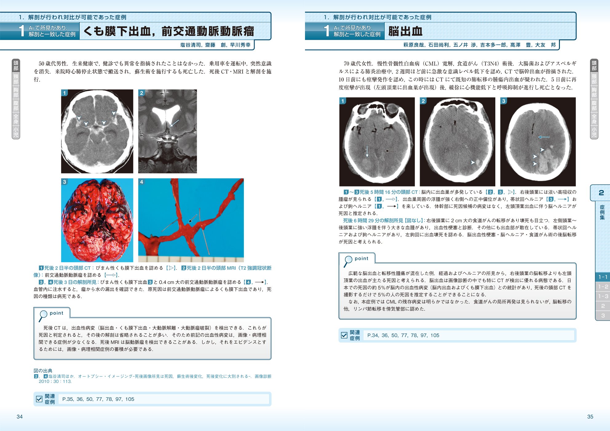 Autopsy Imaging 症例集 死亡時画像診断のための読影マニュアル 高橋 直也 塩谷 清司 本 通販 Amazon