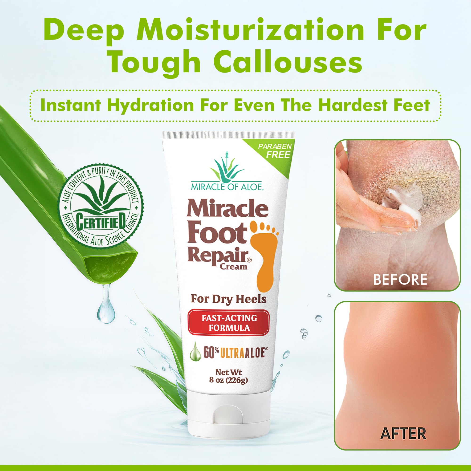 Miracle Foot Repair Cream (8 oz) Repairs Dry Cracked Heels and Feet, 60% Pure UltraAloe Moisturizes, Softens, and Repairs
