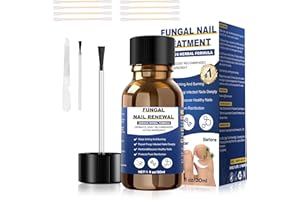 SECHKISS Toenail Fungus Treatment,Foot Fungus Treatment Extra Strength,Fungus Nail Treatment, Toe Nail Fungus Treatments For Fungi Nail yellow toenail treatment(1fl oz/30ml)