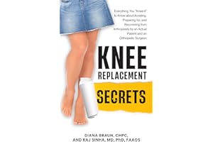 Knee Replacement Secrets: Everything You "Knee'd" to Know About Avoiding, Preparing For, and Recovering From Arthroplasty by 