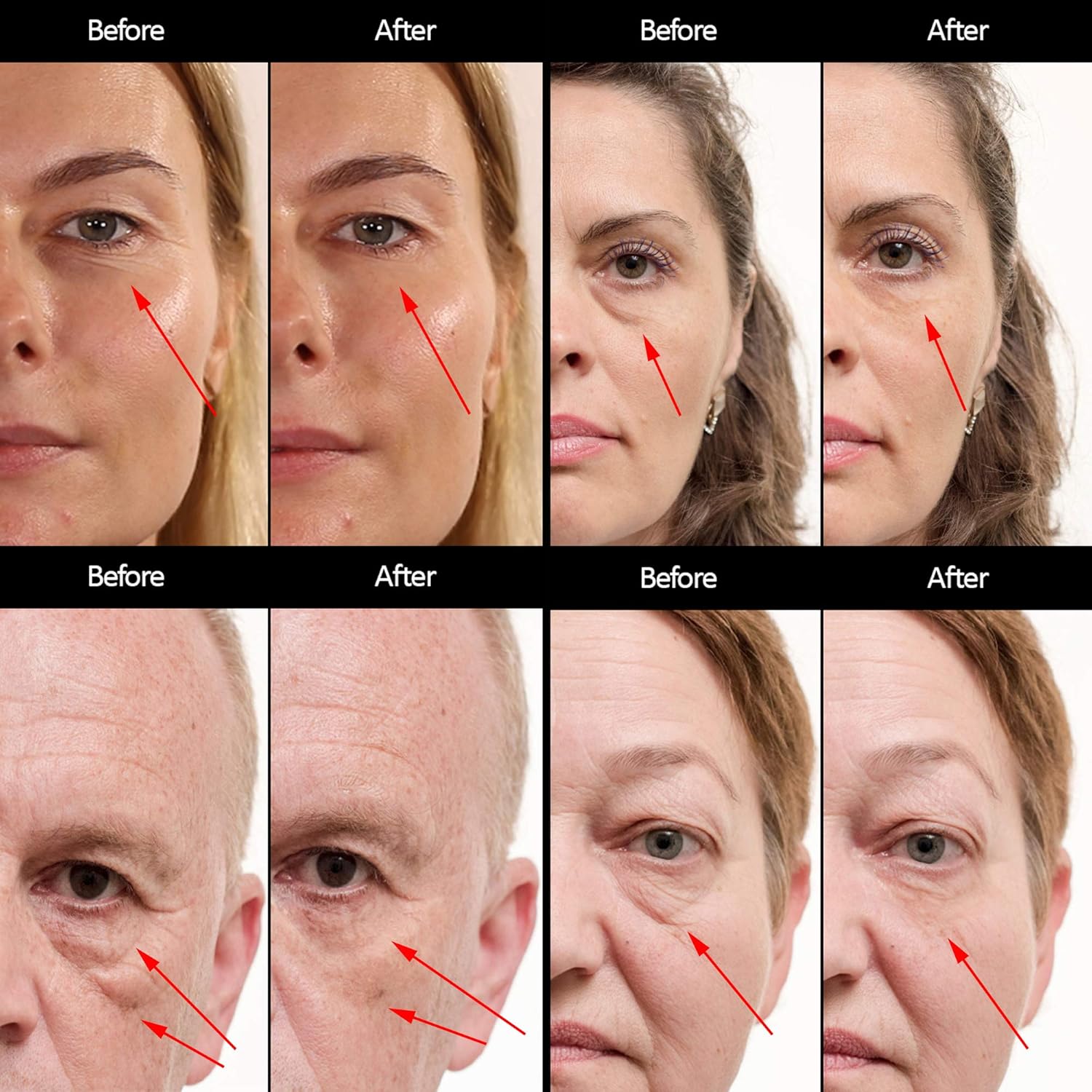 Puffy Eyes Treatment Instant results – Naturally Eliminate Wrinkles, Puffiness, Dark Circle and Bags in Minutes – Hydrating Eye Cream w/Green Tea Extract, Dead Sea Minerals by SEAMANTIKA – .8 oz: Beauty