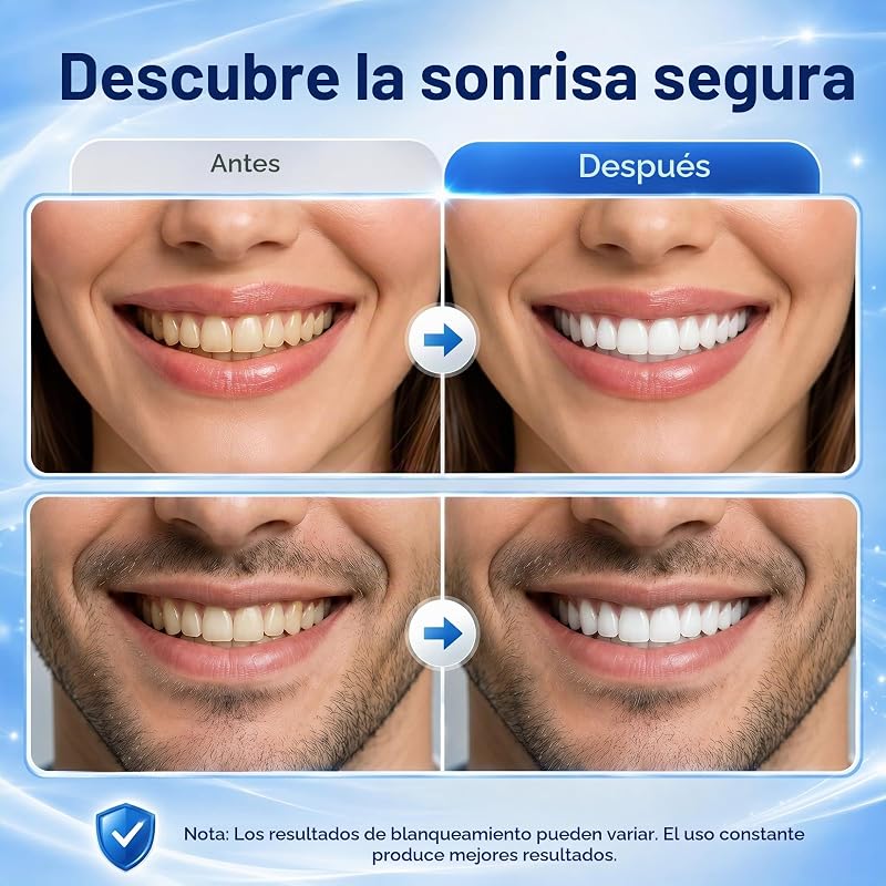 Tiras Blanqueadoras Dientes Sin Sensibilidad Sabor Coco 28 Tiras