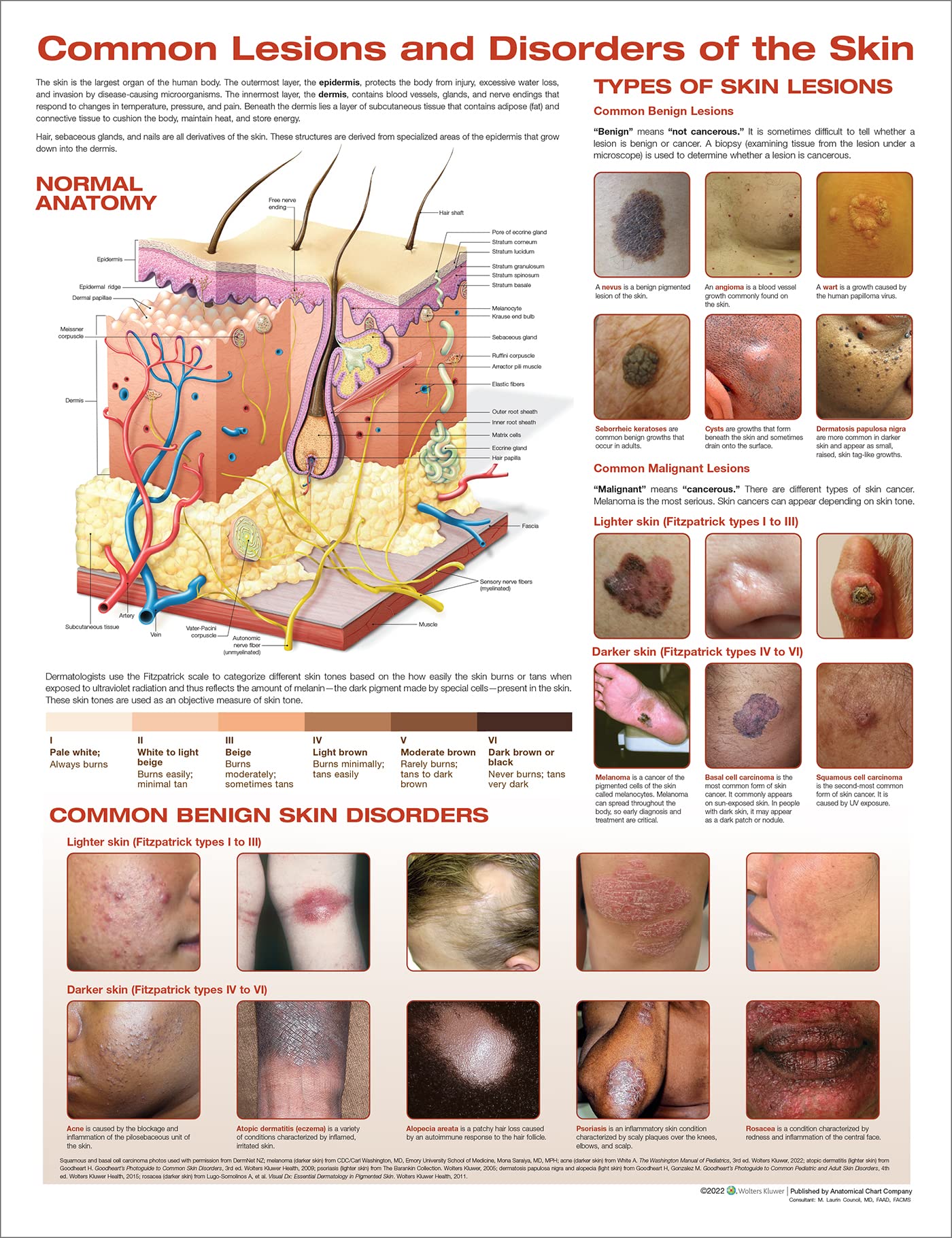 The Skin and Common Disorders Anatomical Chart
