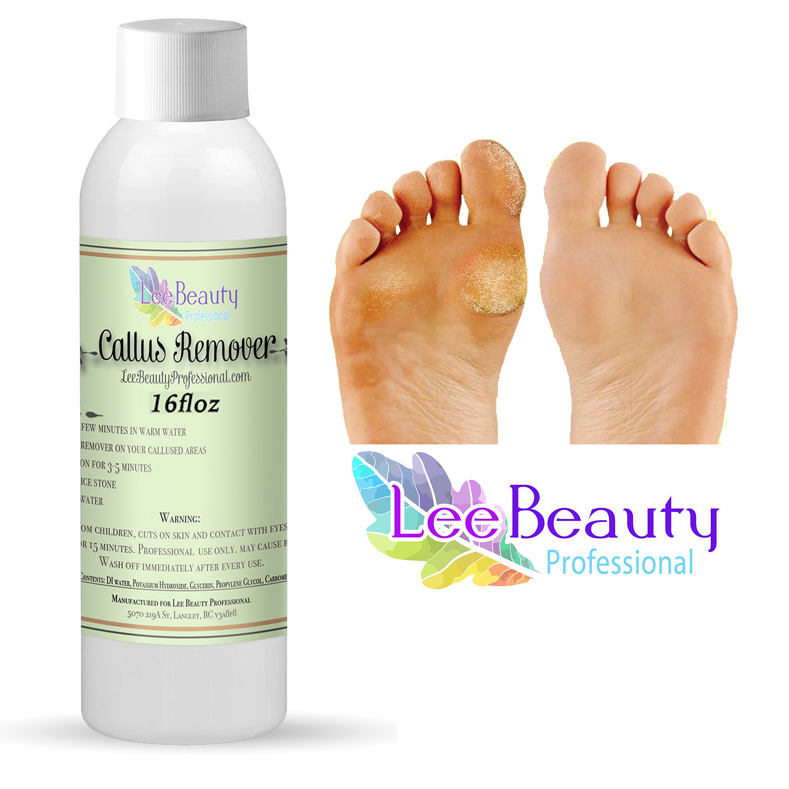 Best Callus Remover.Callus Eliminator,Liquid & Gel For Corn And Callus