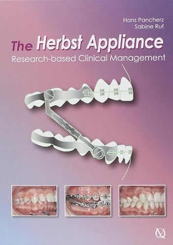 Download The Herbst Appliance: Research Based Clinical Management PDF
