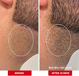 First Aid Beauty Ingrown Hair Pads with BHA & AHA – 60 Pads Daily Treatment view 4