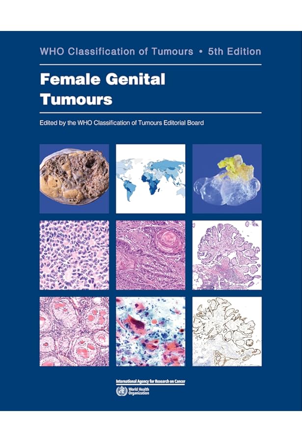 洋書 Breast Tumours , WHO 5th edition Front cover of the 5th edition of WHO Classification of Tumours