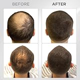 THICK FIBER Hair Fibres 25g Dark Brown Thickening Hair Powder view 9