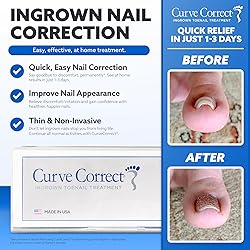 CurveCorrect® Ingrown Toenail Treatment Kit