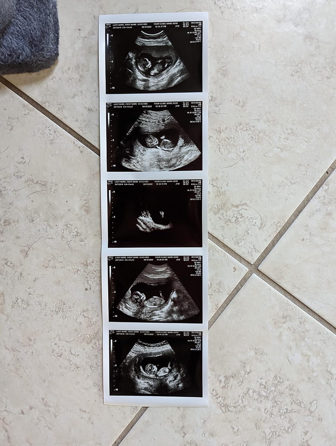 Photographs - Prank 2D Customized Fake Ultrasound Strip of 5 Photos (item must be folded to ship)