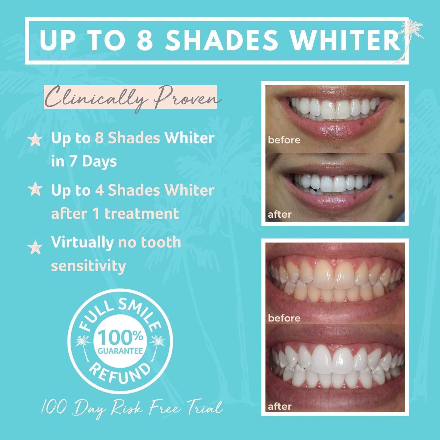 Cali White Vegan Teeth WHITENING KIT with LED Light, Made in USA, Natural & Organic Peroxide Gel, Professional Dental Whitener, Best Home System: 2 X 5mL Syringes, Custom Trays, Retainer Case: Beauty