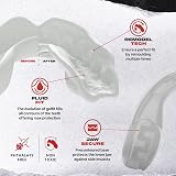 SAFEJAWZ Mouthguard Slim Fit Junior Case Clear view 4