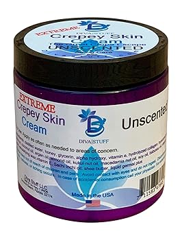 cream for crepey arms