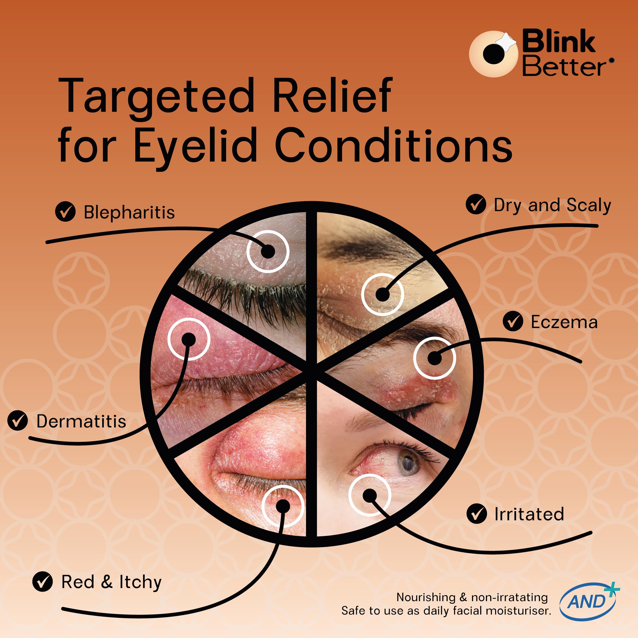 BlinkBetter® Restore Eyelid Cream – 3% Oat Extract & Ceramide Complex – Soothing Hydration & Barrier Support for Dry, Itchy, Red, Sensitive, or Flaky Skin Around the Eyes – All-Day Use – 1oz